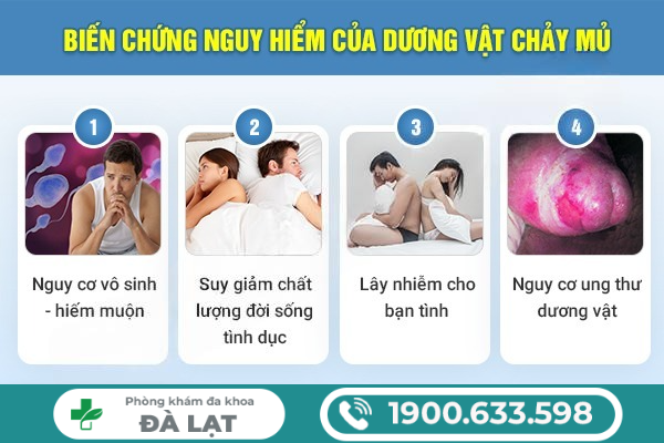 Hình ảnh minh họa
